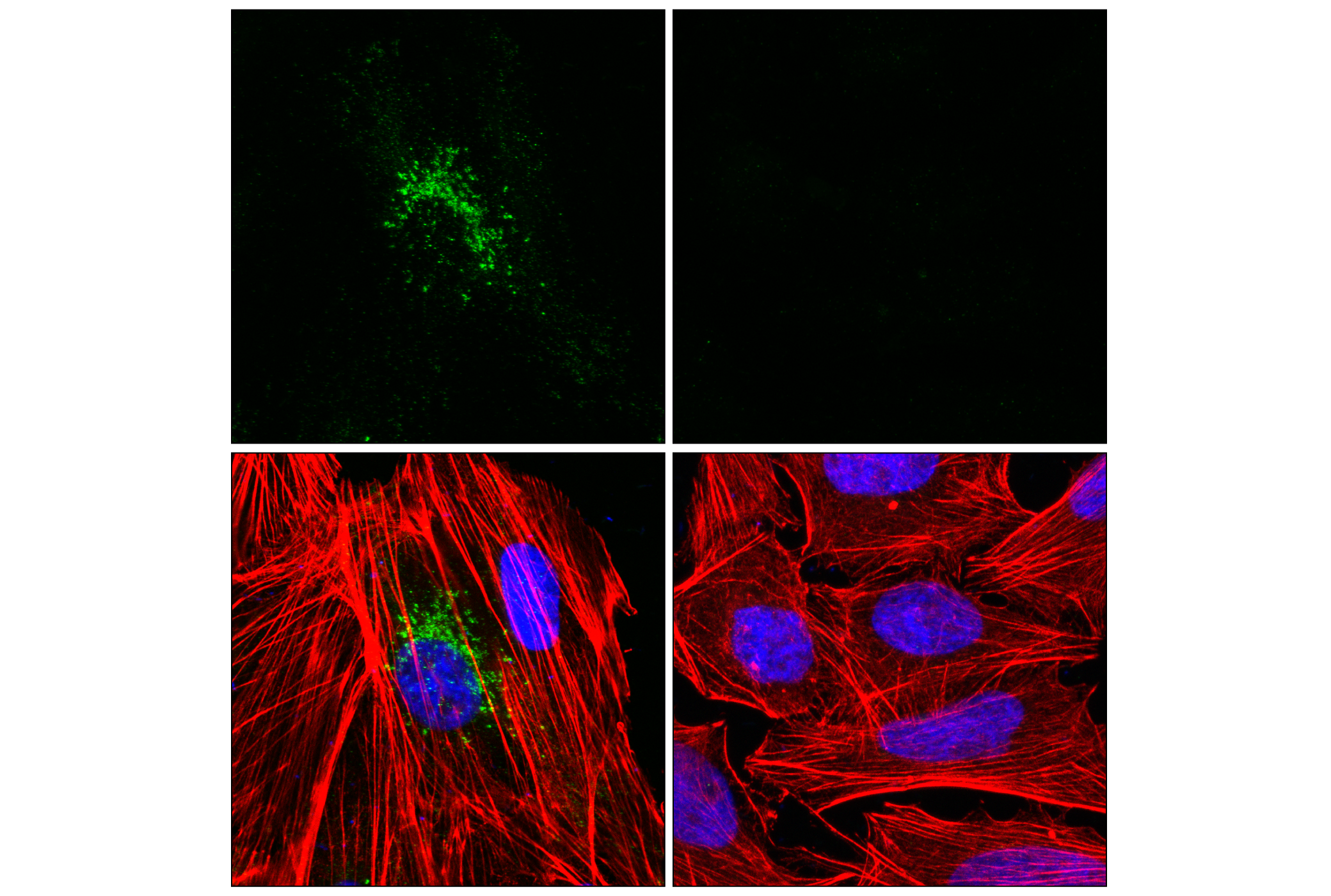 Immunofluorescence Image 1: CXCL6 (E6V8D) Rabbit mAb
