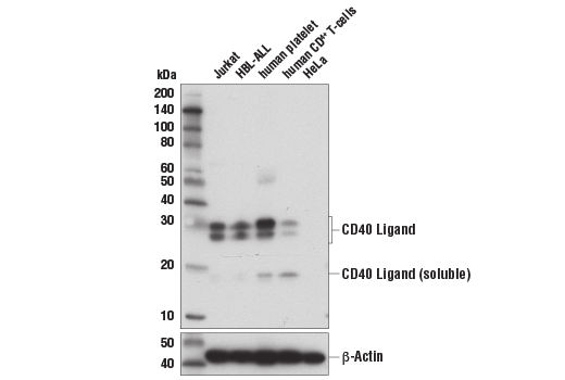 Western Blotting Image 2: CD40 Ligand (D5J9Y) Rabbit mAb (BSA and Azide Free)