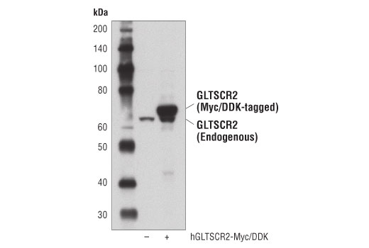 Western Blotting Image 1: GLTSCR2 Antibody