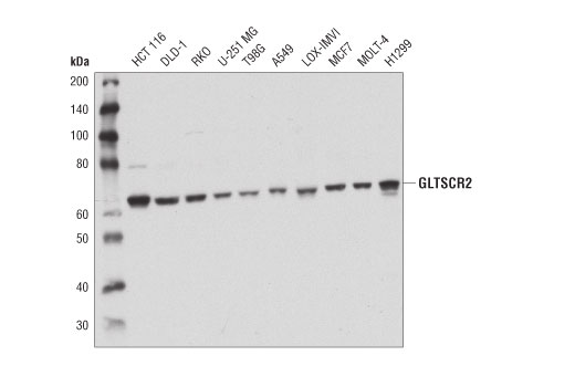 Western Blotting Image 2: GLTSCR2 Antibody