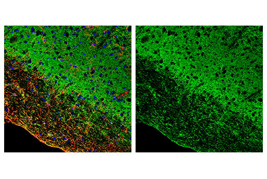 Immunofluorescence Image 2: EAAT2 (E3P5K) Rabbit mAb (BSA and Azide Free)