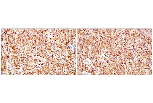Immunohistochemistry Image 12: Nestin (E4O9E) XP® Rabbit mAb (BSA and Azide Free)