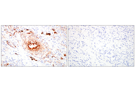 Immunohistochemistry Image 13: Nestin (E4O9E) XP® Rabbit mAb (BSA and Azide Free)