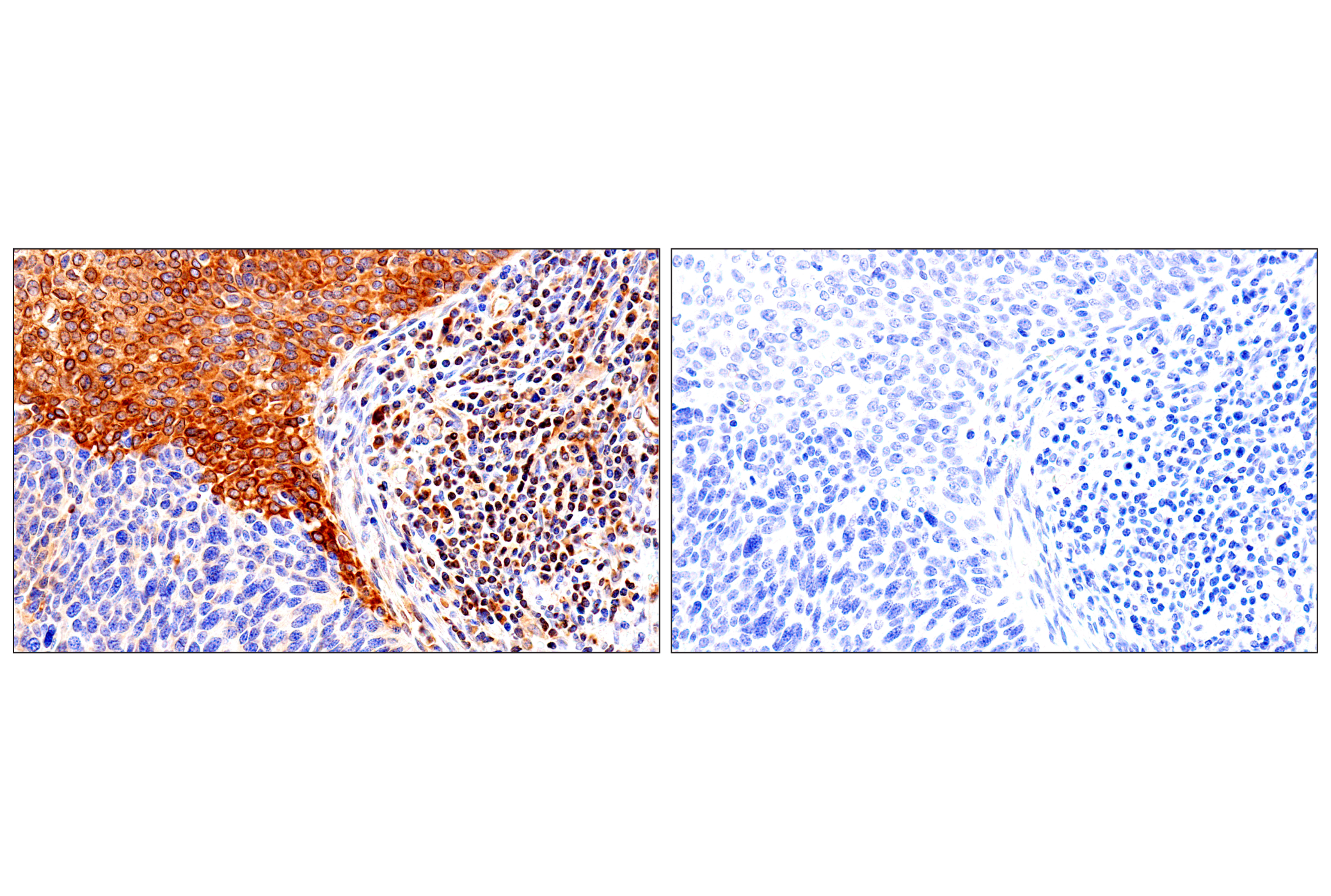Immunohistochemistry Image 19: HLA-E (MEM-E/02) Mouse mAb