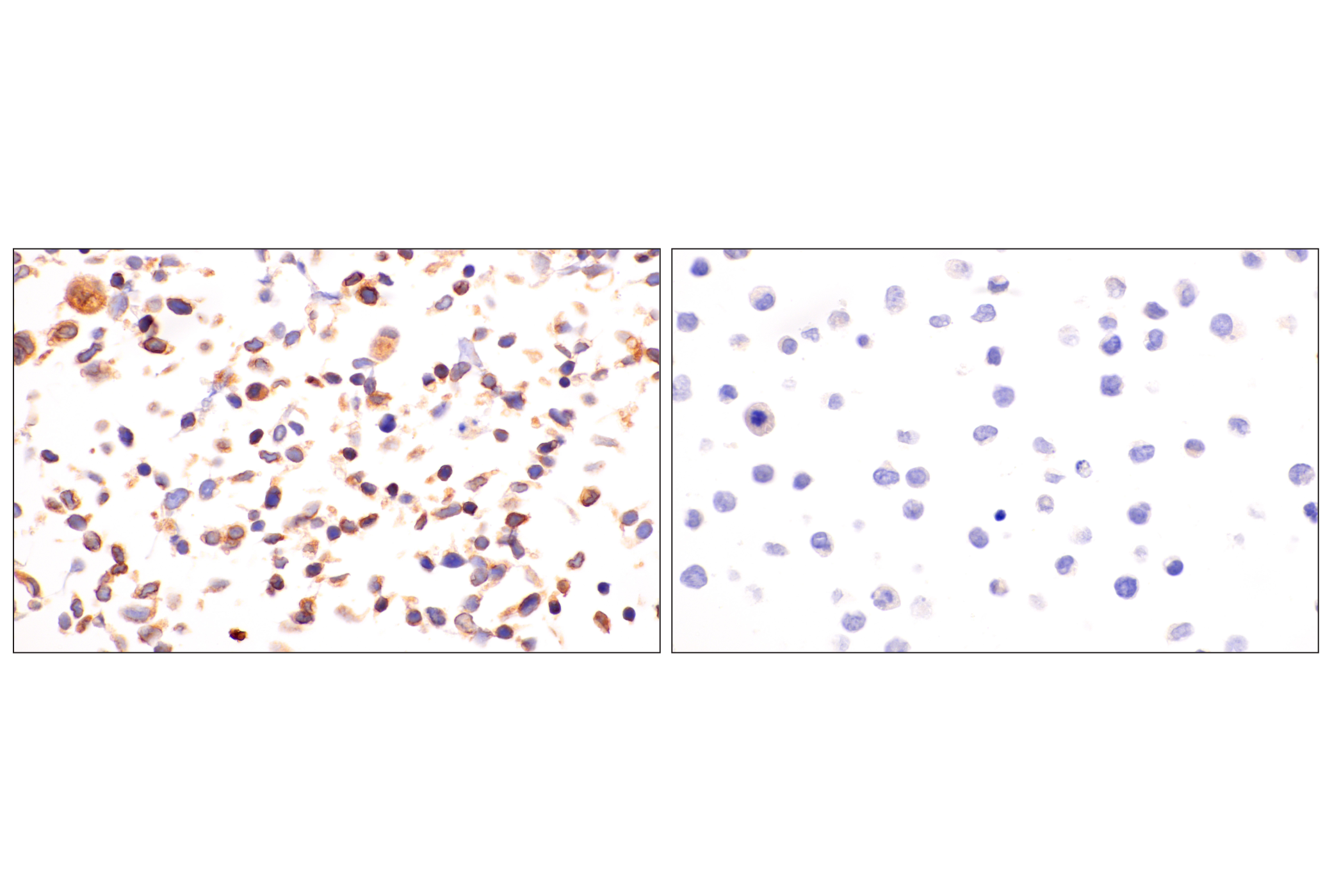 Immunohistochemistry Image 20: HLA-E (MEM-E/02) Mouse mAb