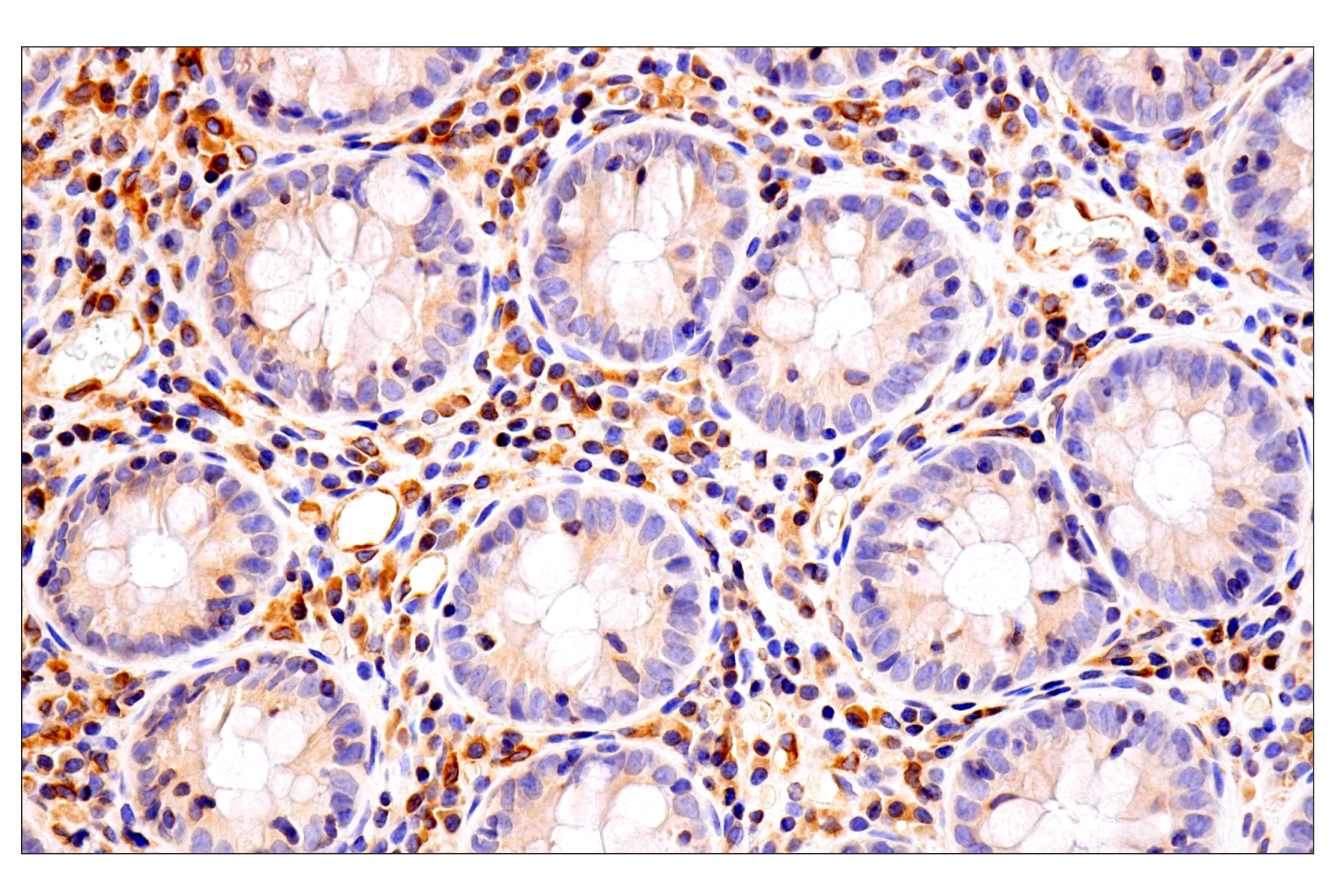 Immunohistochemistry Image 2: HLA-E (MEM-E/02) Mouse mAb