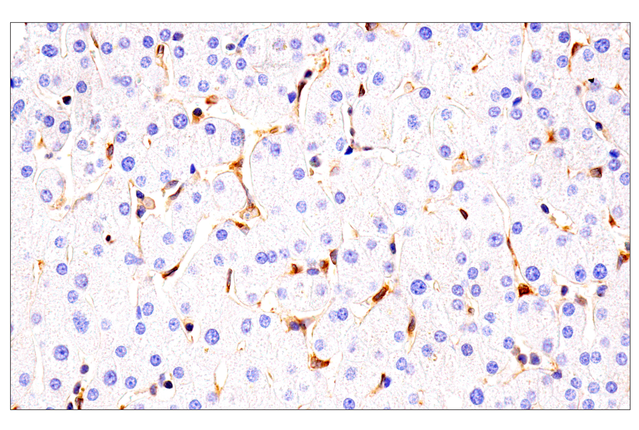 Immunohistochemistry Image 10: HLA-E (MEM-E/02) Mouse mAb