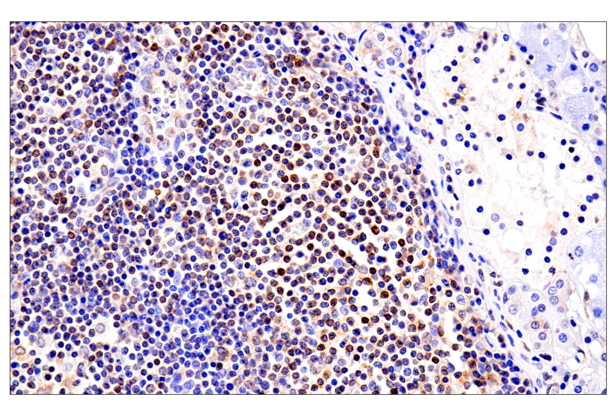Immunohistochemistry Image 9: HLA-E (MEM-E/02) Mouse mAb