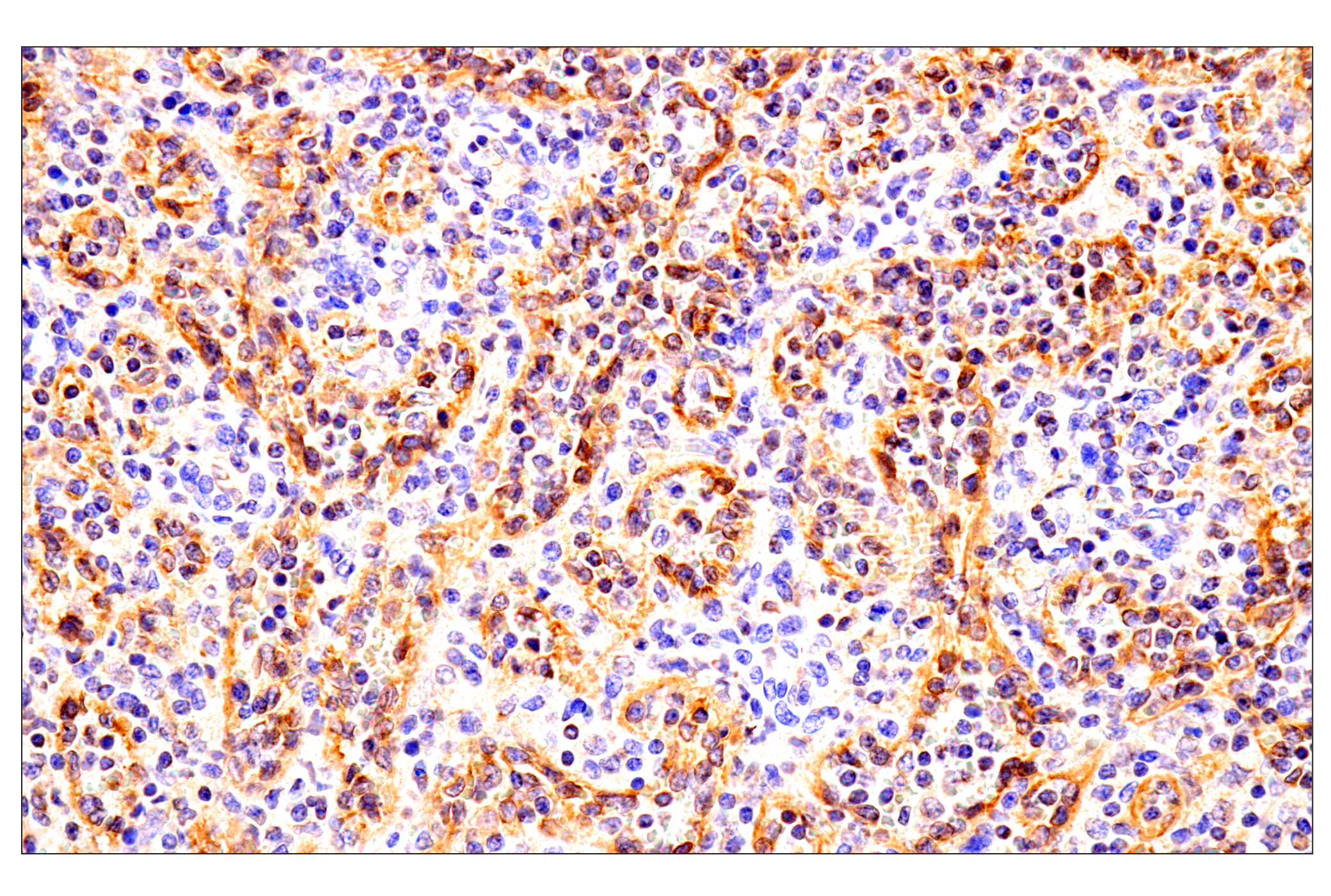 Immunohistochemistry Image 1: HLA-E (MEM-E/02) Mouse mAb