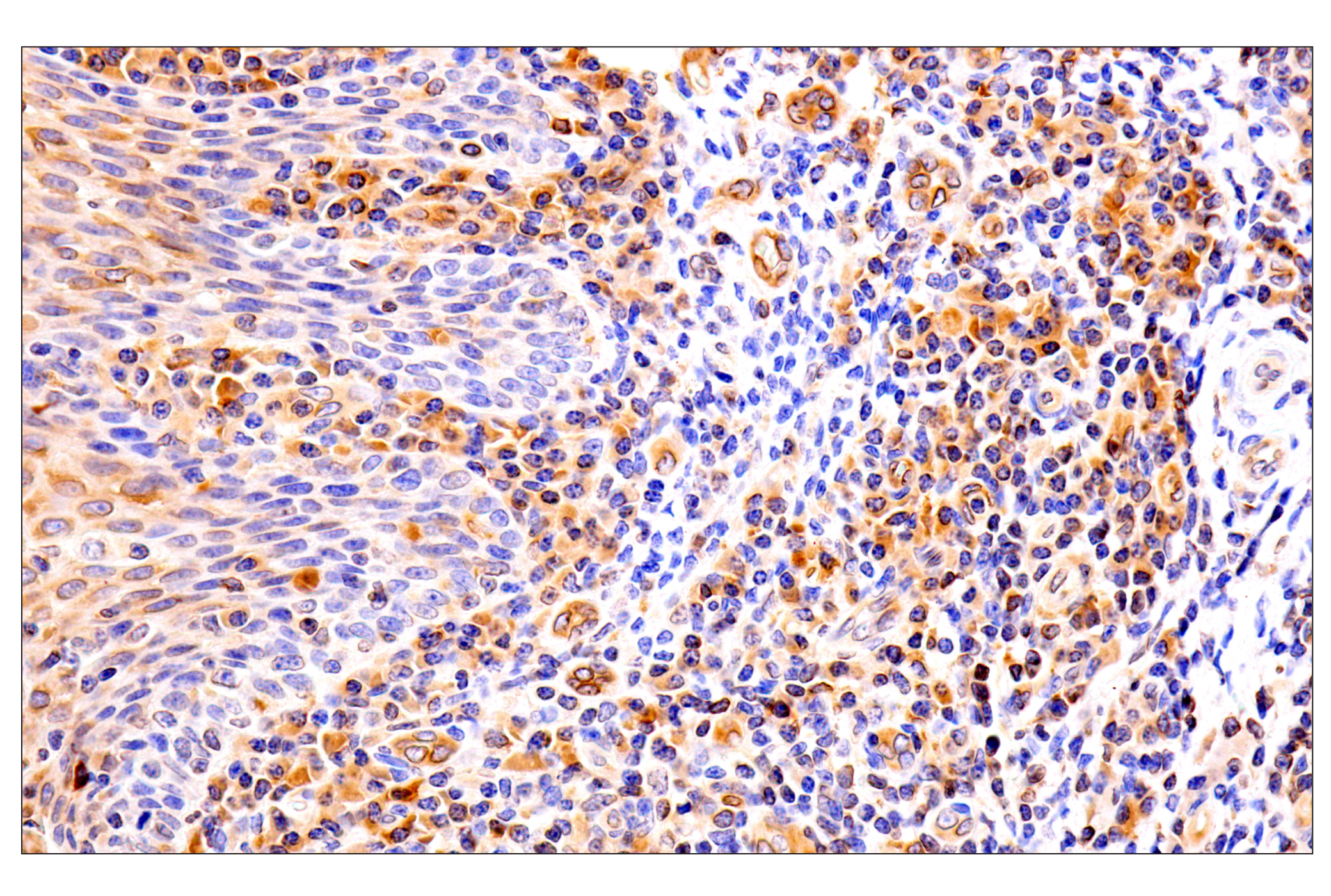 Immunohistochemistry Image 14: HLA-E (MEM-E/02) Mouse mAb