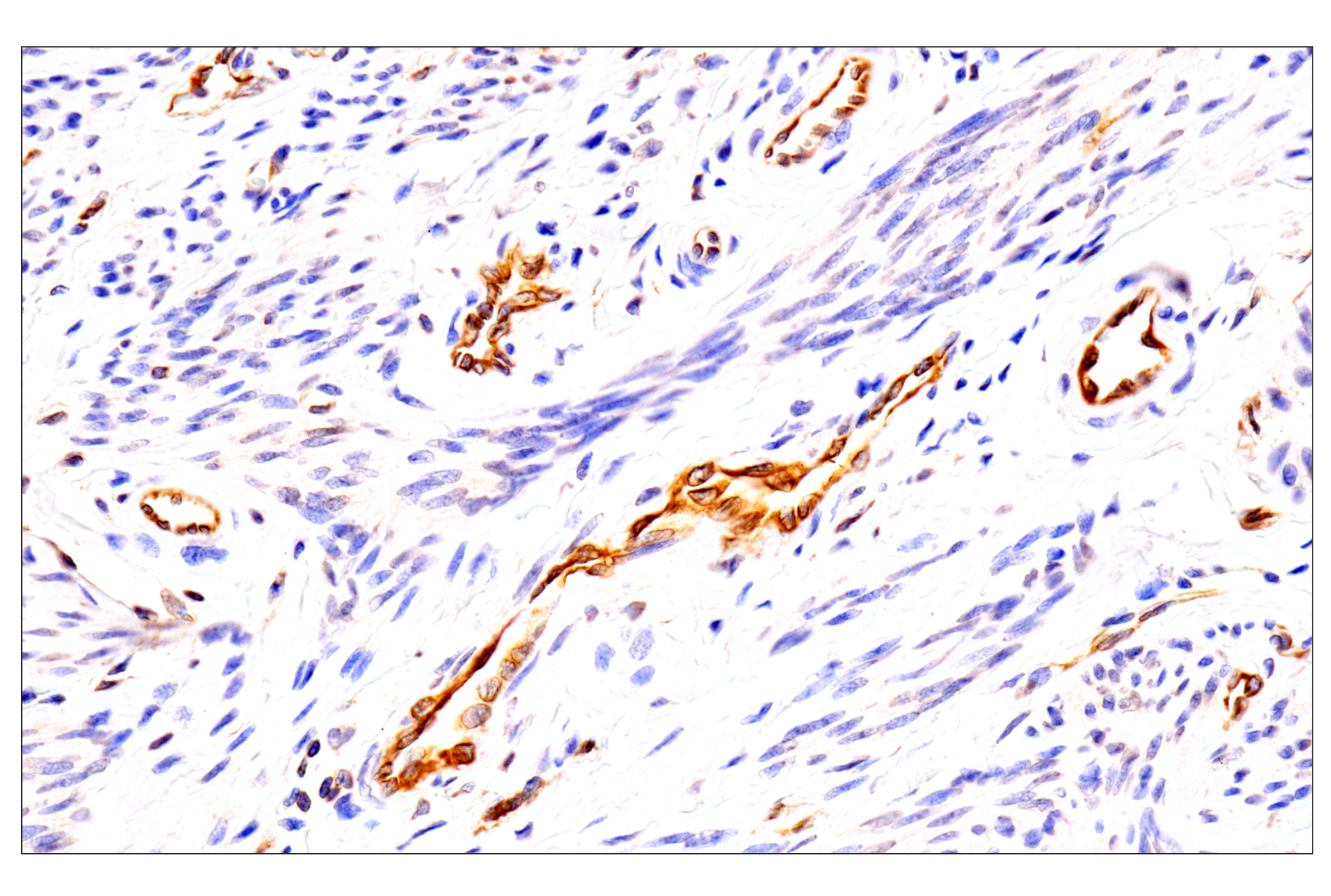Immunohistochemistry Image 3: HLA-E (MEM-E/02) Mouse mAb