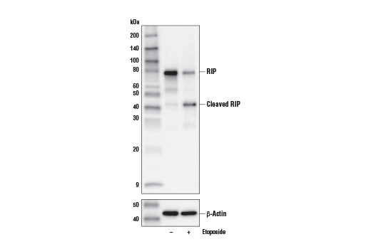  Image 25: Apoptosis/Necroptosis Antibody Sampler Kit II