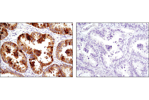 Immunohistochemistry Image 11: Cox2 (D5H5) XP® Rabbit mAb (BSA and Azide Free)