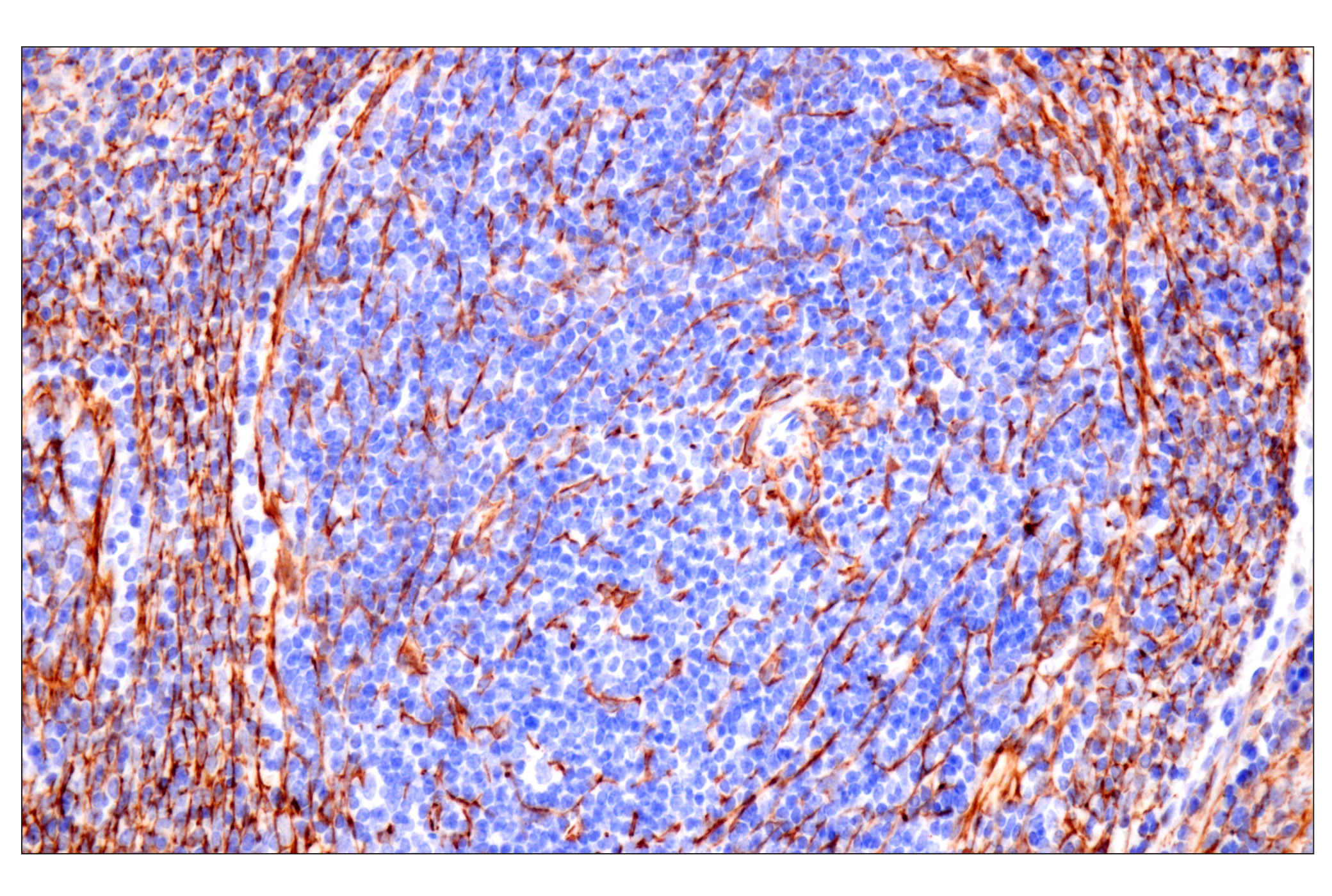 Immunohistochemistry Image 14: Desmin (F5V4I) Rabbit mAb