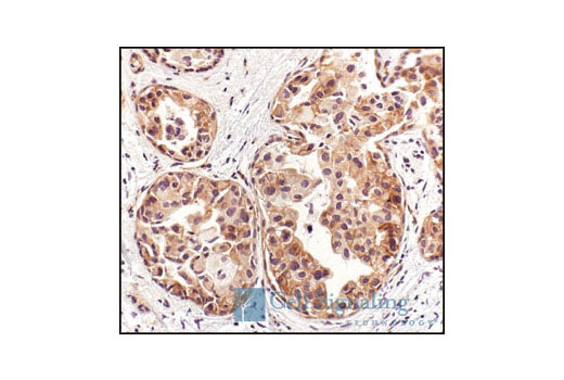 Immunohistochemistry Image 1: Phospho-HER3/ErbB3 (Tyr1289) (21D3) Rabbit mAb (BSA and Azide Free)