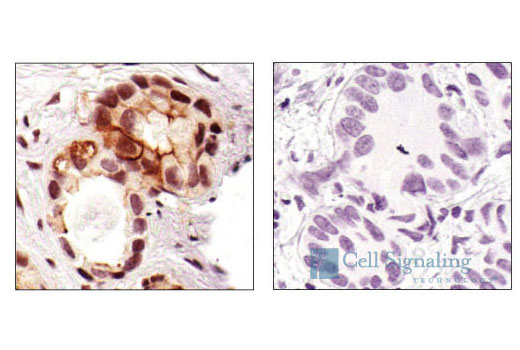 Immunohistochemistry Image 4: Phospho-HER3/ErbB3 (Tyr1289) (21D3) Rabbit mAb (BSA and Azide Free)