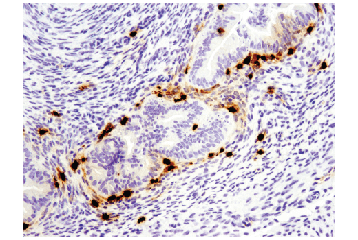 Immunohistochemistry Image 1: S100A9 (D3U8M) Rabbit mAb (BSA and Azide Free)