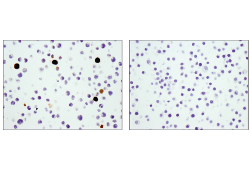 Immunohistochemistry Image 2: S100A9 (D3U8M) Rabbit mAb (BSA and Azide Free)