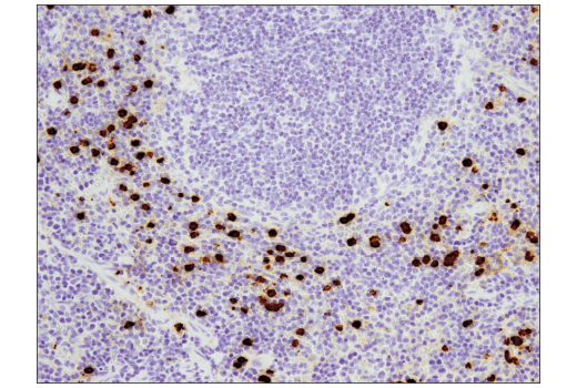 Immunohistochemistry Image 3: S100A9 (D3U8M) Rabbit mAb