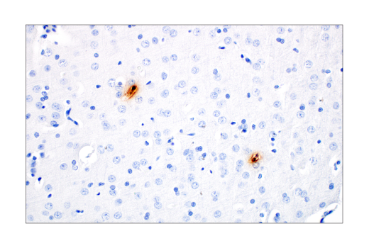 Immunohistochemistry Image 3: S100A9 (D3U8M) Rabbit mAb (BSA and Azide Free)