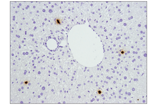 Immunohistochemistry Image 6: S100A9 (D3U8M) Rabbit mAb (BSA and Azide Free)