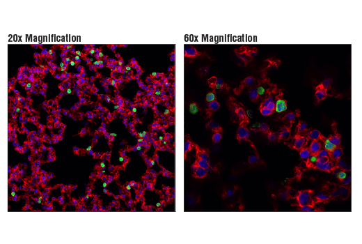 Immunofluorescence Image 1: S100A9 (D3U8M) Rabbit mAb (BSA and Azide Free)