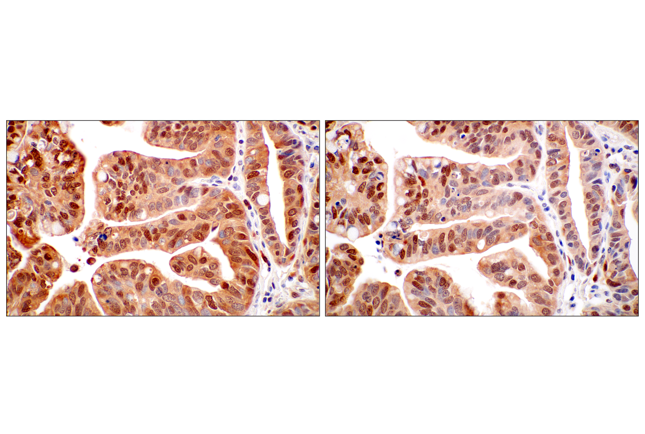 Immunohistochemistry Image 8: SerpinB1 (E4W7B) Rabbit mAb (BSA and Azide Free)