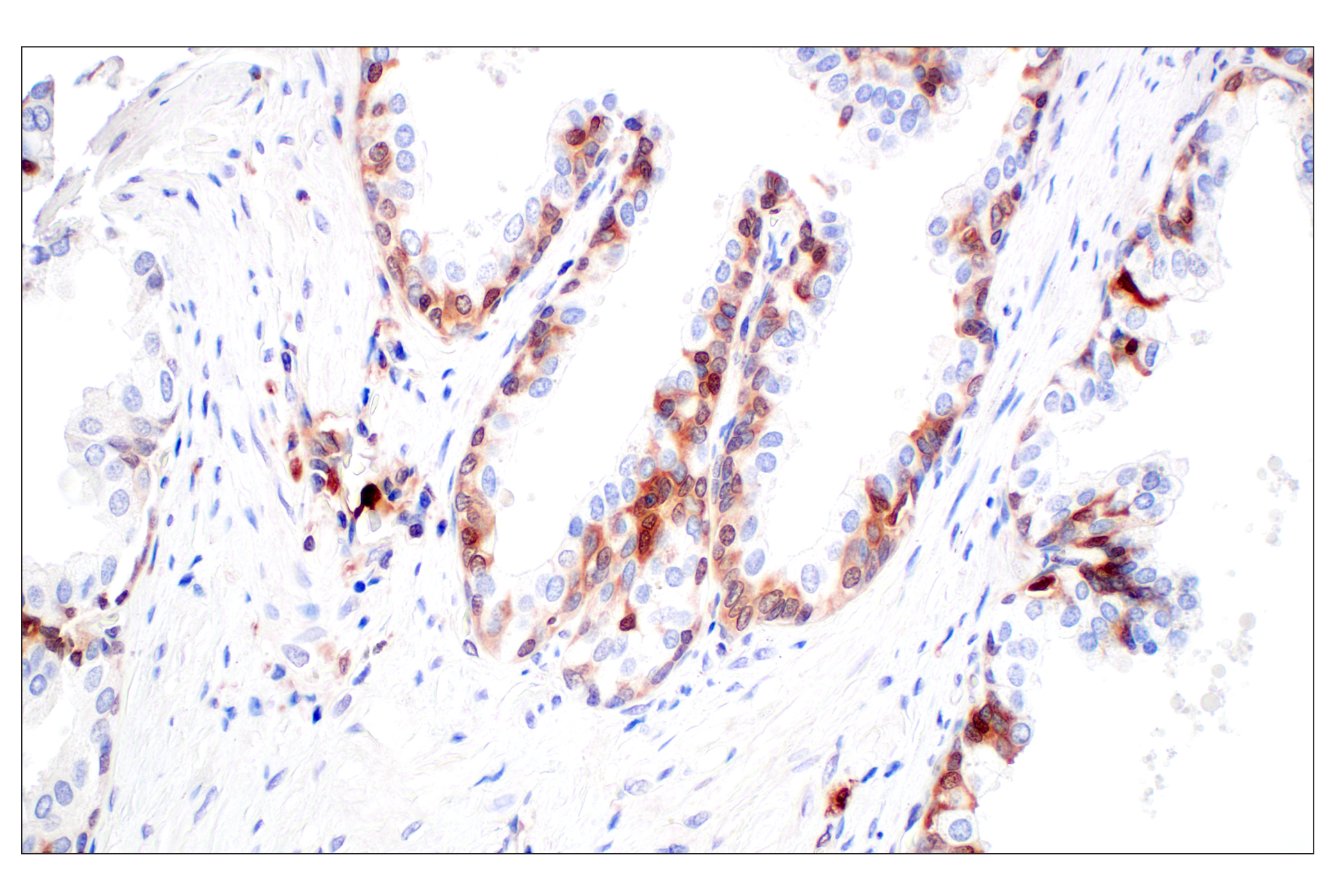 Immunohistochemistry Image 6: SerpinB1 (E4W7B) Rabbit mAb (BSA and Azide Free)