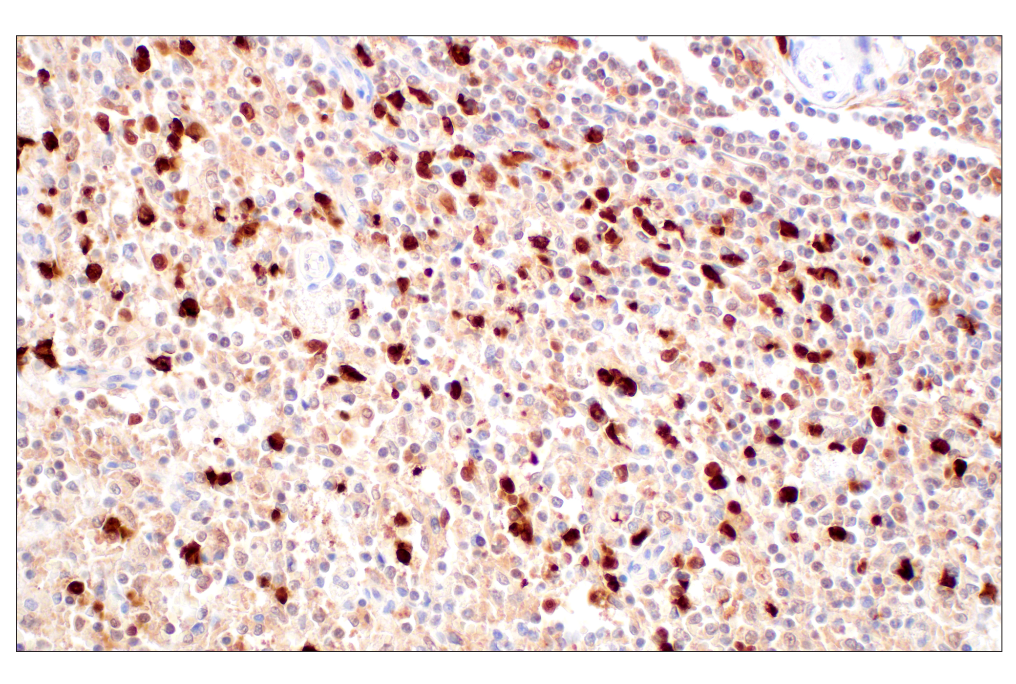 Immunohistochemistry Image 7: SerpinB1 (E4W7B) Rabbit mAb (BSA and Azide Free)