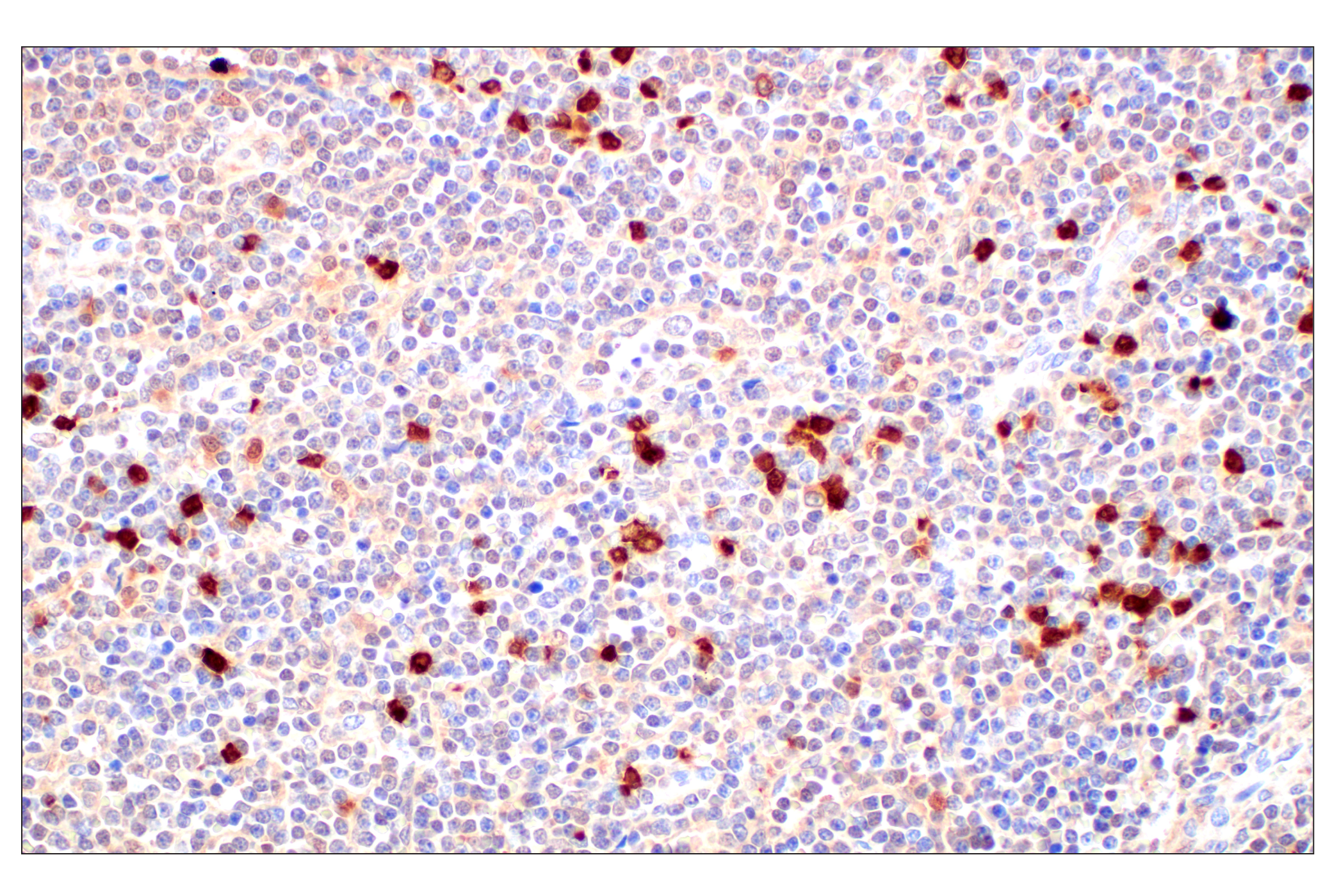 Immunohistochemistry Image 1: SerpinB1 (E4W7B) Rabbit mAb (BSA and Azide Free)