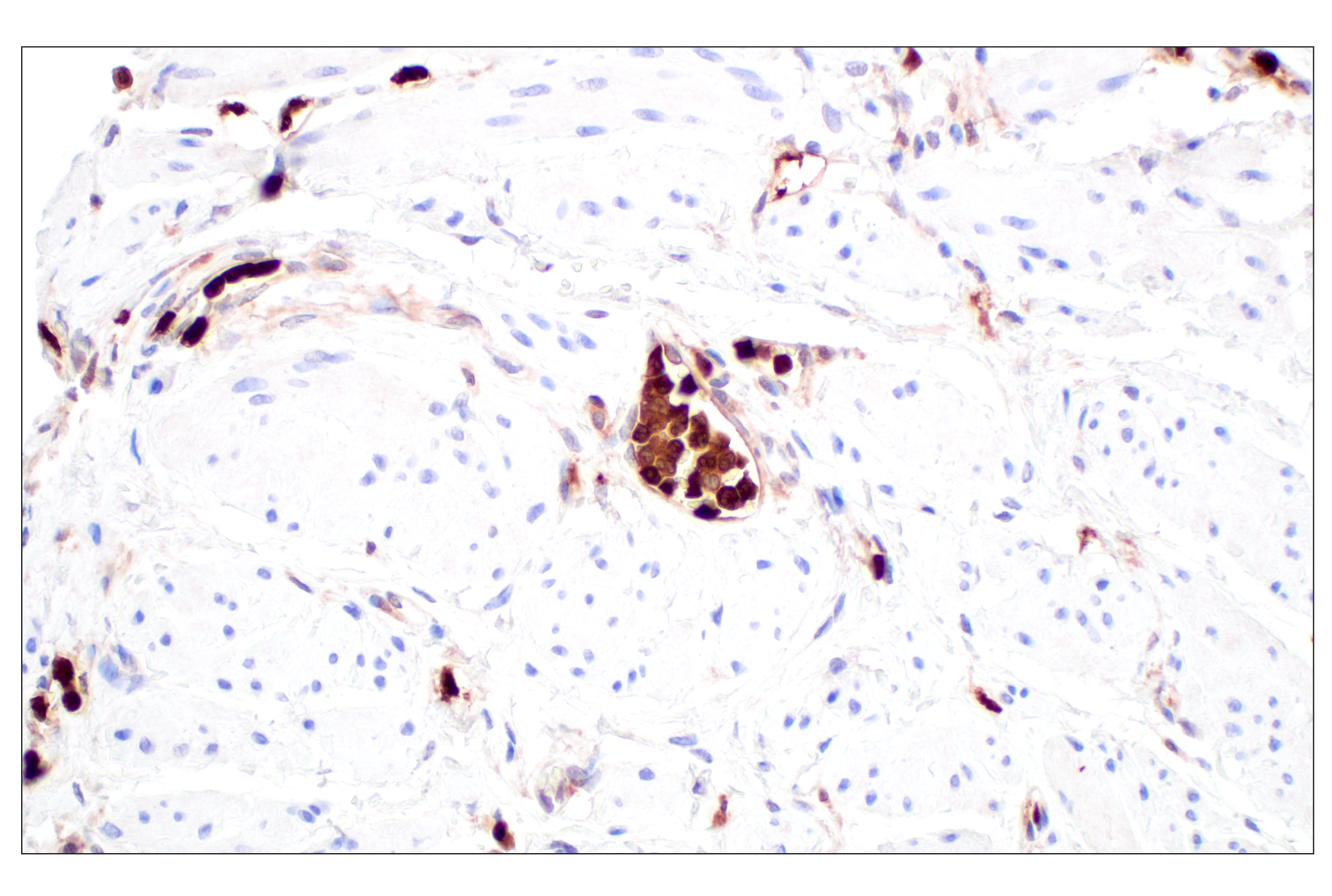 Immunohistochemistry Image 4: SerpinB1 (E4W7B) Rabbit mAb (BSA and Azide Free)