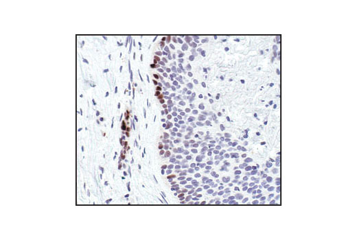 Immunohistochemistry Image 6: Phospho-Stat3 (Tyr705) (D3A7) XP ® Rabbit mAb (BSA and Azide Free)