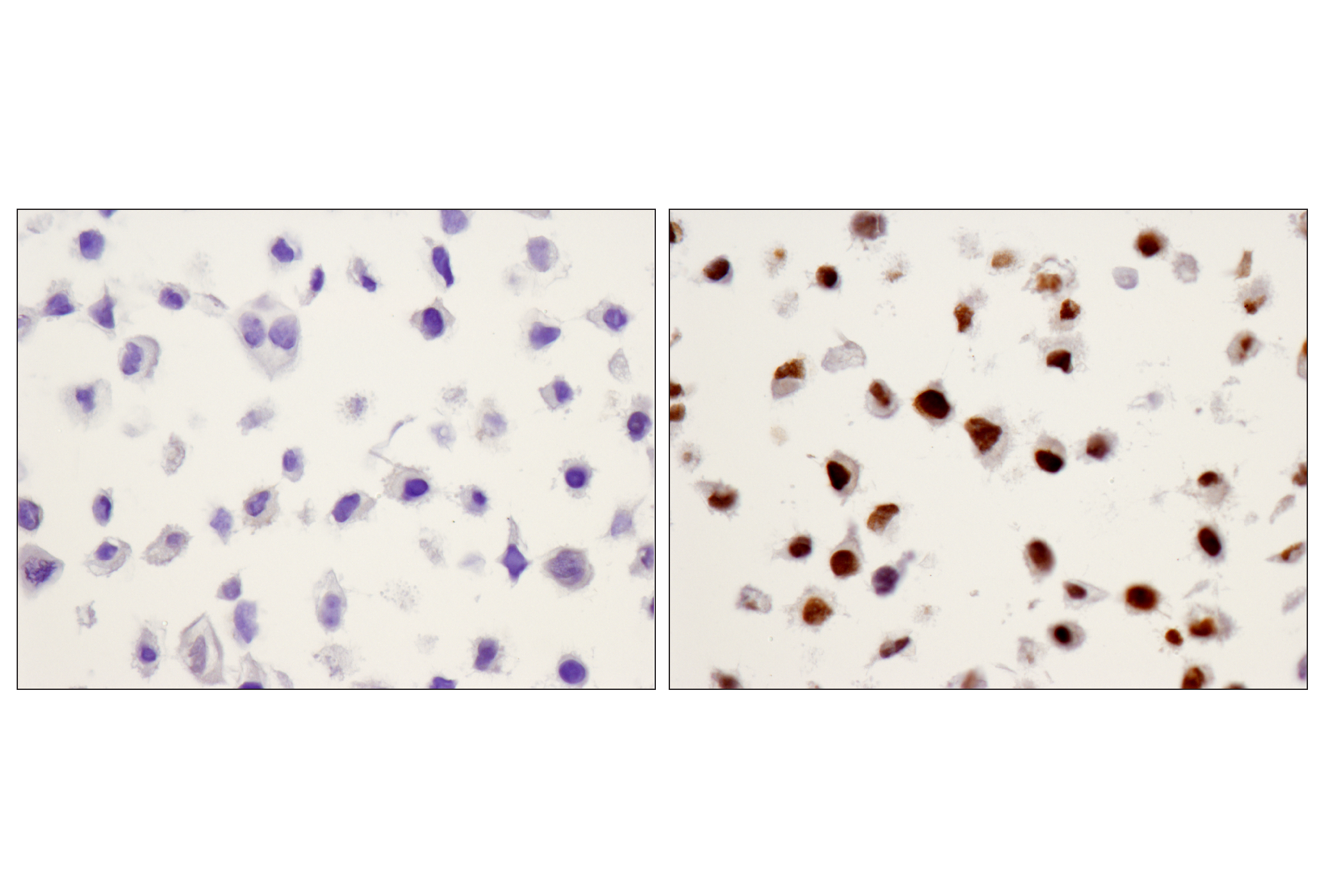 Immunohistochemistry Image 6: Phospho-Stat3 (Tyr705) (D3A7) XP® Rabbit mAb (BSA and Azide Free)