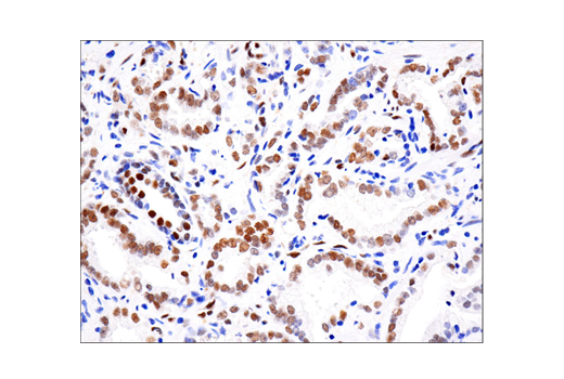 Immunohistochemistry Image 1: Phospho-Stat3 (Tyr705) (D3A7) XP ® Rabbit mAb (BSA and Azide Free)