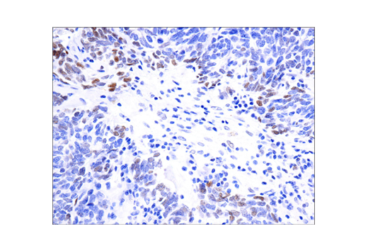 Immunohistochemistry Image 2: Phospho-Stat3 (Tyr705) (D3A7) XP® Rabbit mAb (BSA and Azide Free)