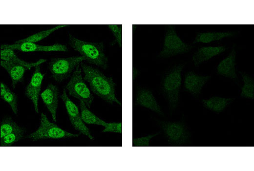 Immunofluorescence Image 1: Phospho-Stat3 (Tyr705) (D3A7) XP ® Rabbit mAb (BSA and Azide Free)