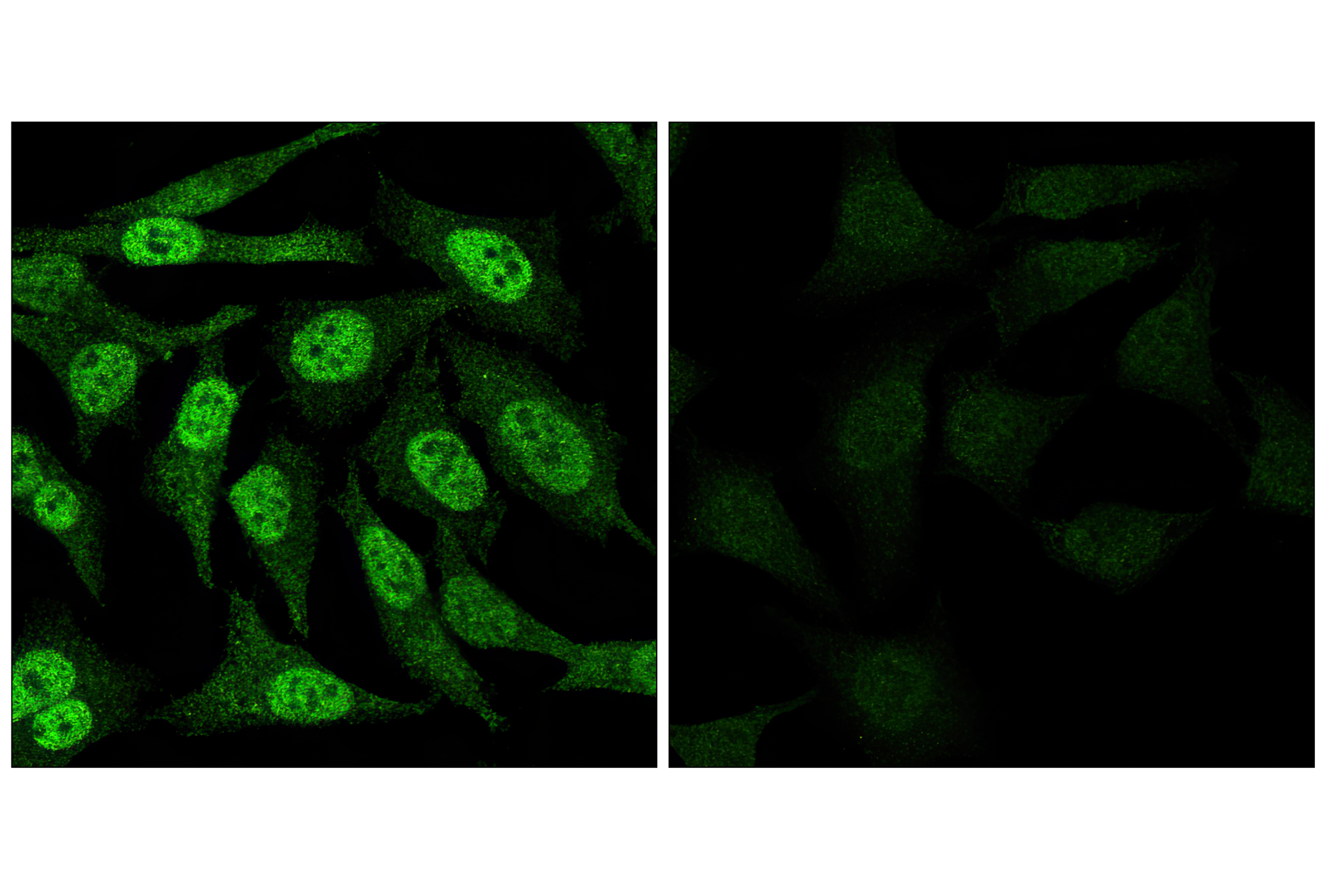 Immunofluorescence Image 1: Phospho-Stat3 (Tyr705) (D3A7) XP® Rabbit mAb (BSA and Azide Free)