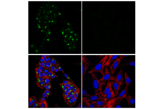 Immunofluorescence Image 1: ITM2A (E7G8A) Rabbit mAb