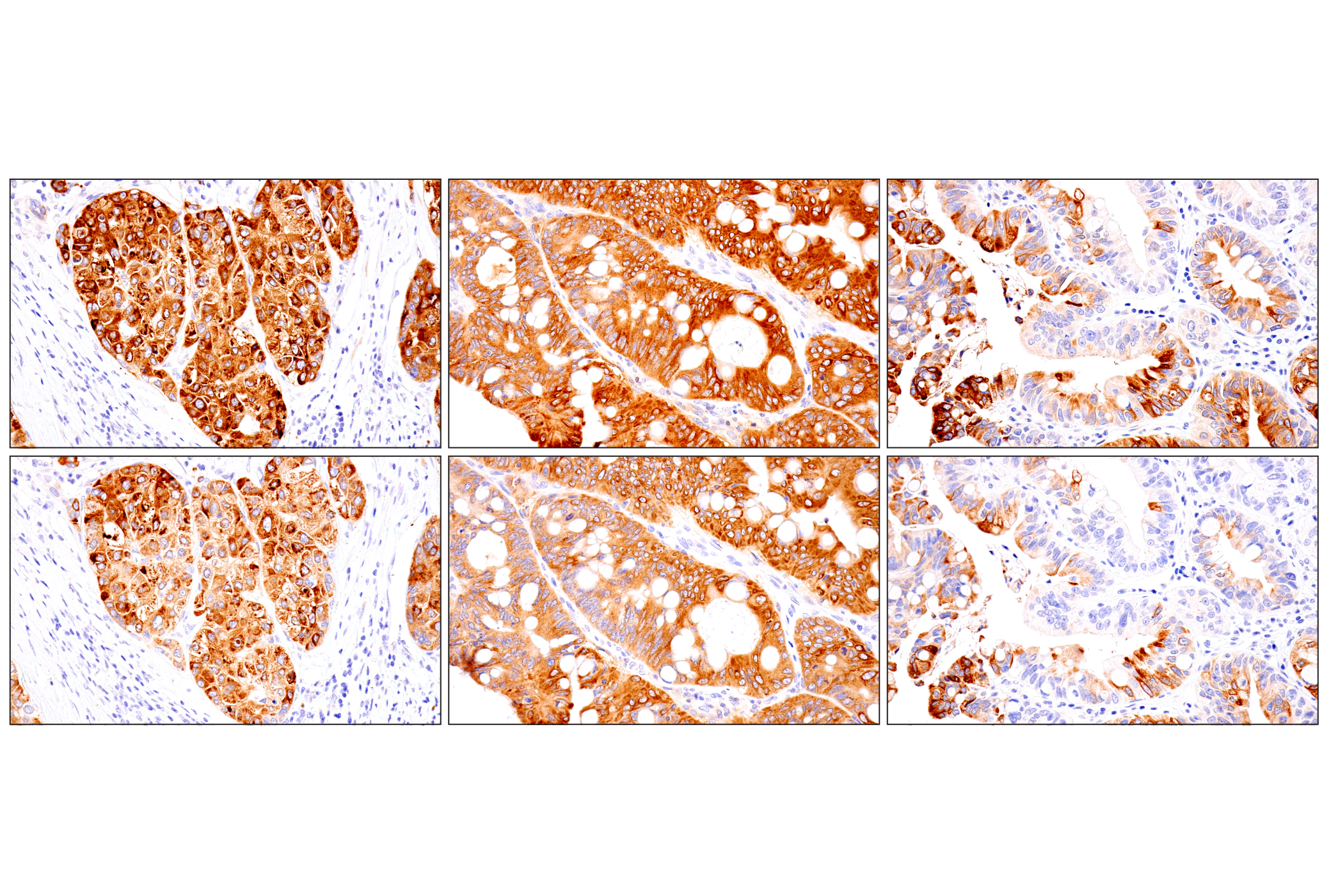 Immunohistochemistry Image 10: ENTPD5 (E5U3V) Rabbit mAb