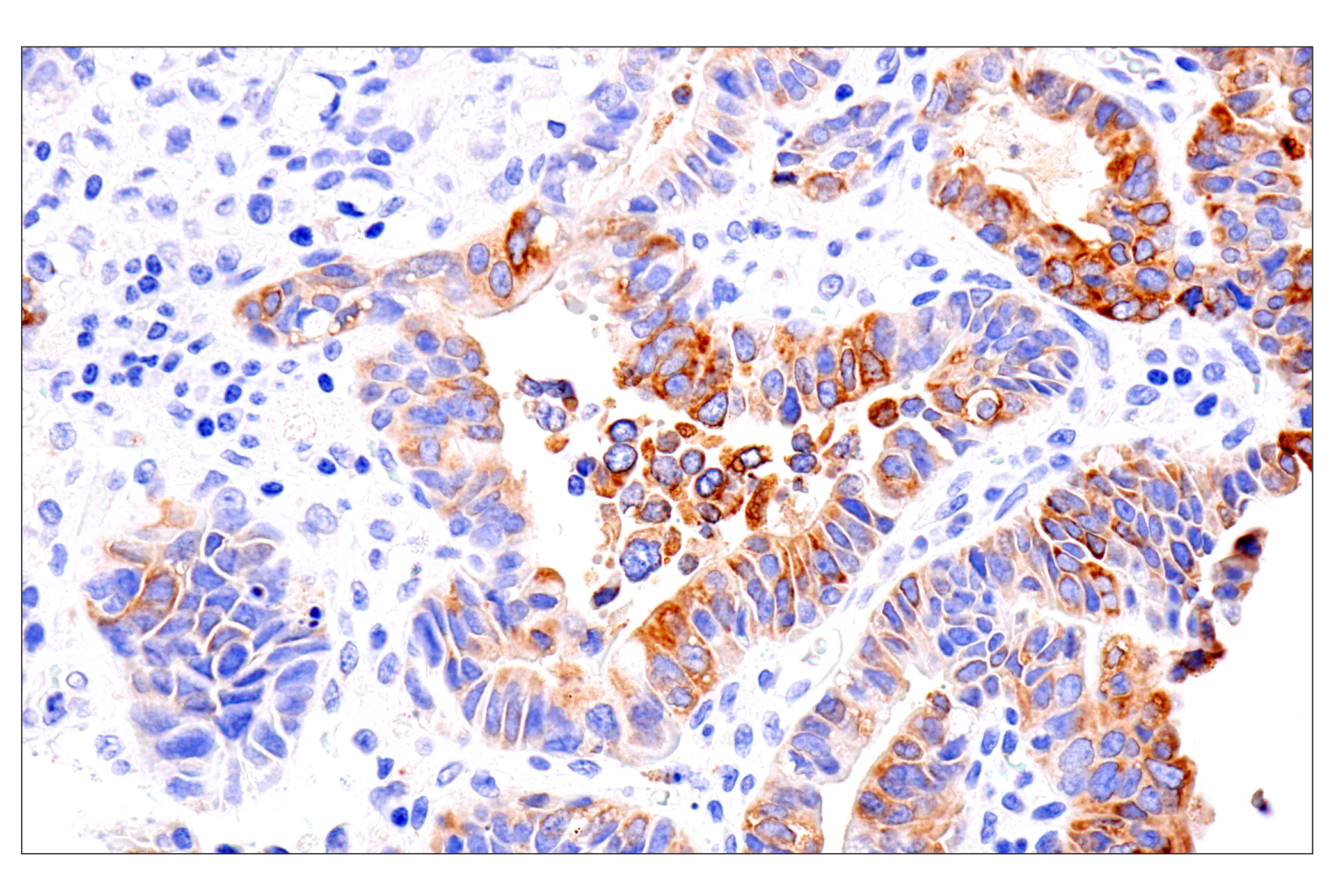 Immunohistochemistry Image 2: ENTPD5 (E5U3V) Rabbit mAb