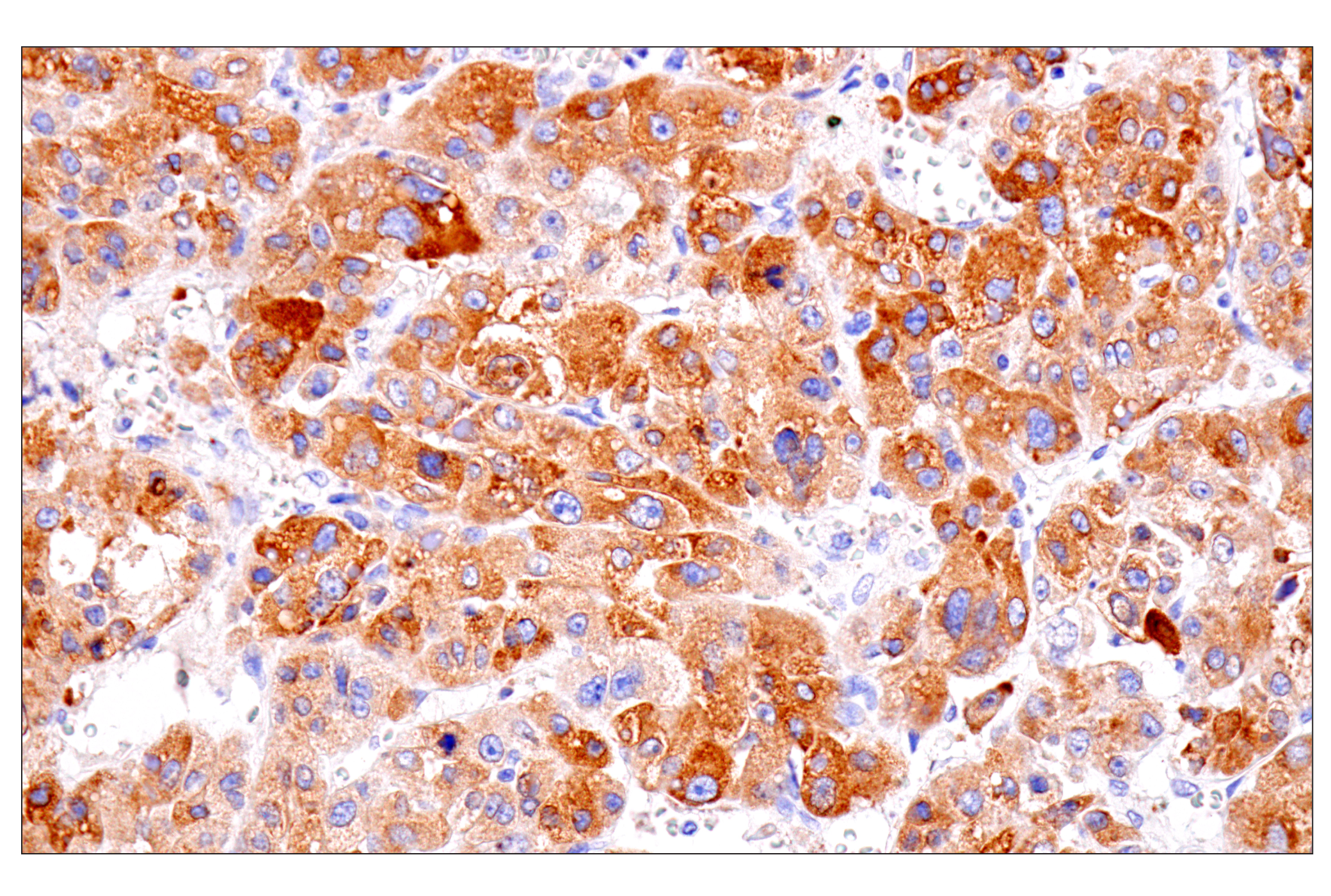 Immunohistochemistry Image 1: ENTPD5 (E5U3V) Rabbit mAb