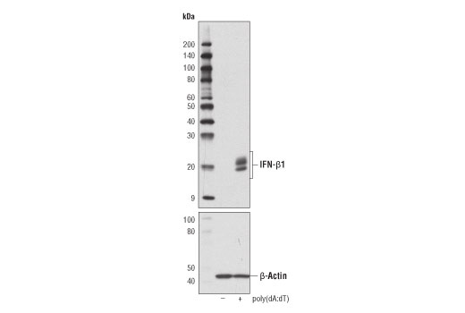  Image 11: Type I Interferon Induction and Signaling Antibody Sampler Kit
