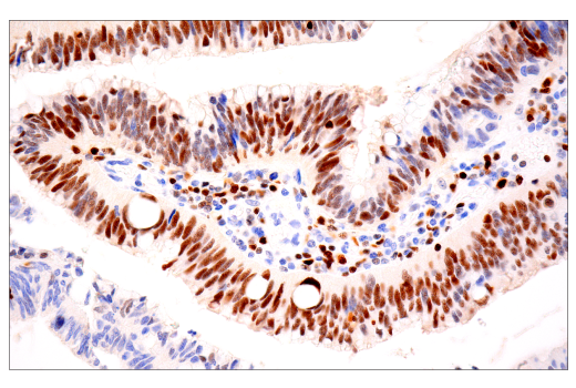  Image 45: Human Exhausted CD8+ T Cell IHC Antibody Sampler Kit