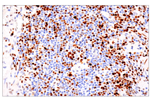  Image 62: Human Exhausted CD8+ T Cell IHC Antibody Sampler Kit
