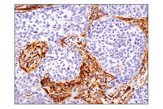 Immunohistochemistry Image 2: Podoplanin (LpMab-12) Mouse mAb (BSA and Azide Free)