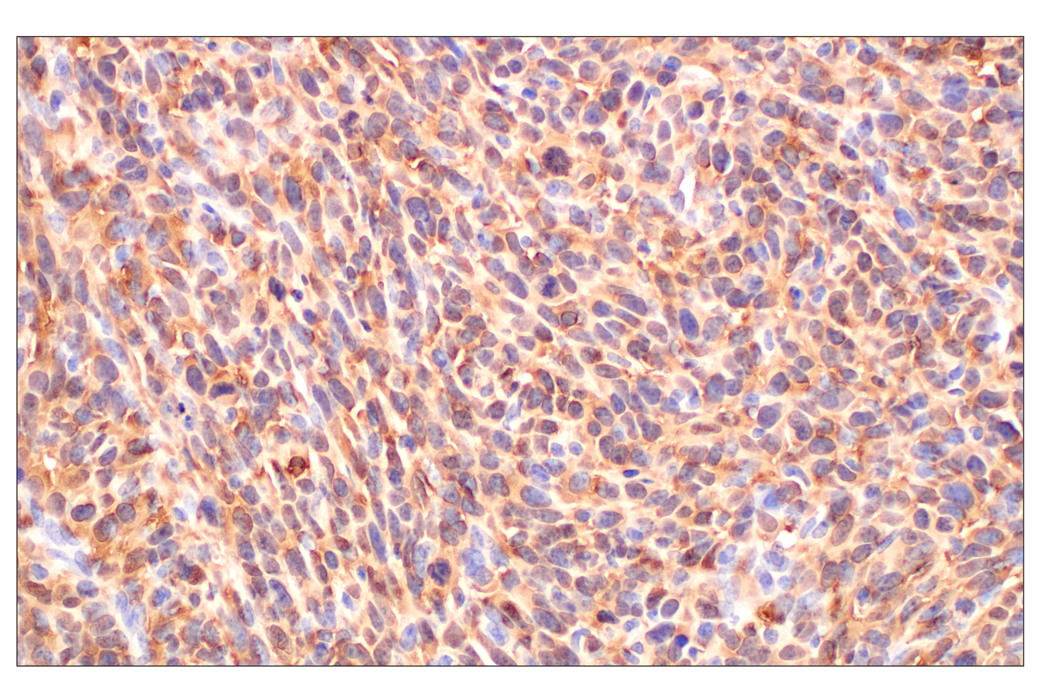 Immunohistochemistry Image 7: MTAP (E5R1I) Rabbit mAb (BSA and Azide Free)