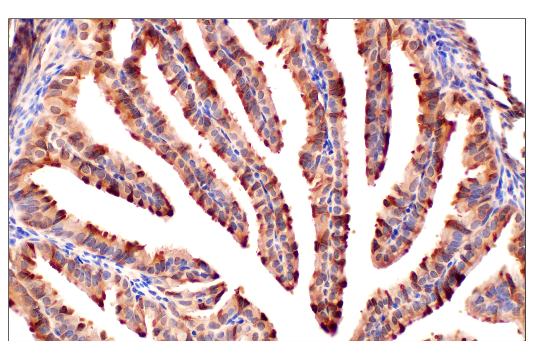 Immunohistochemistry Image 8: MTAP (E5R1I) Rabbit mAb (BSA and Azide Free)