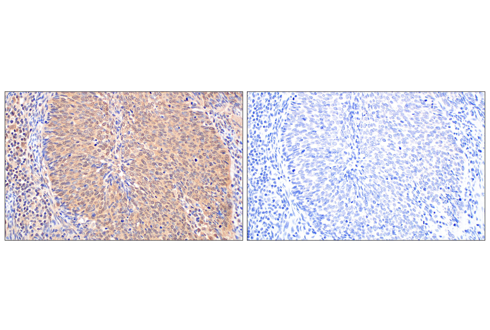 Immunohistochemistry Image 11: MTAP (E5R1I) Rabbit mAb (BSA and Azide Free)