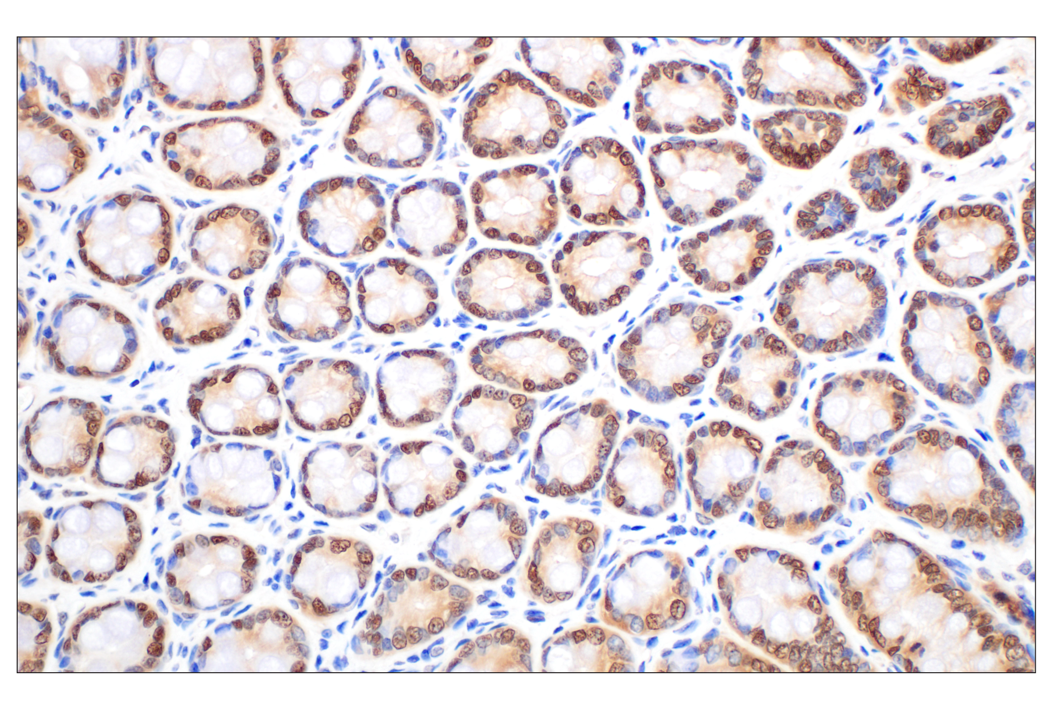 Immunohistochemistry Image 10: MTAP (E5R1I) Rabbit mAb (BSA and Azide Free)