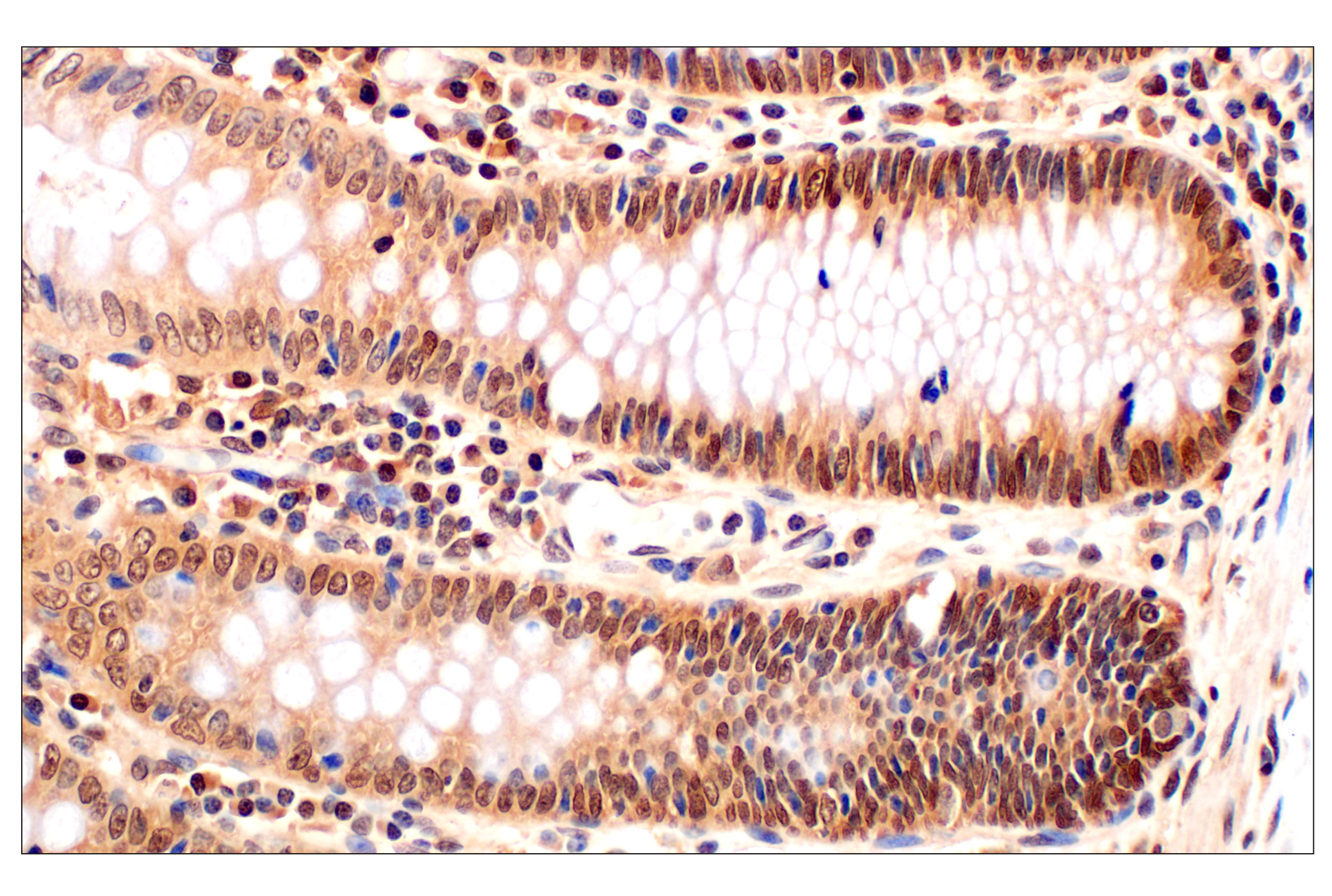 Immunohistochemistry Image 6: MTAP (E5R1I) Rabbit mAb (BSA and Azide Free)